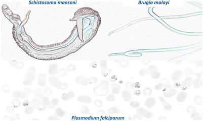 Therapeutic and Diagnostic Innovation for Parasitology: Grand Challenges